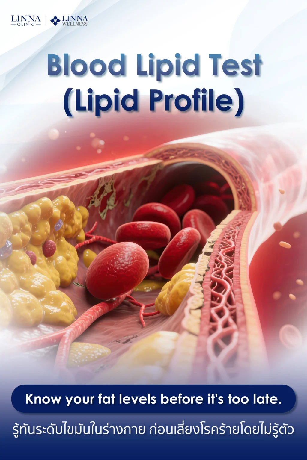 Lipid profile