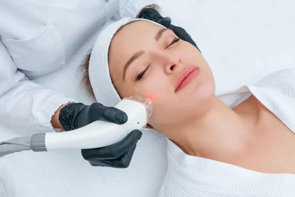 Advanced IPL – Full Face