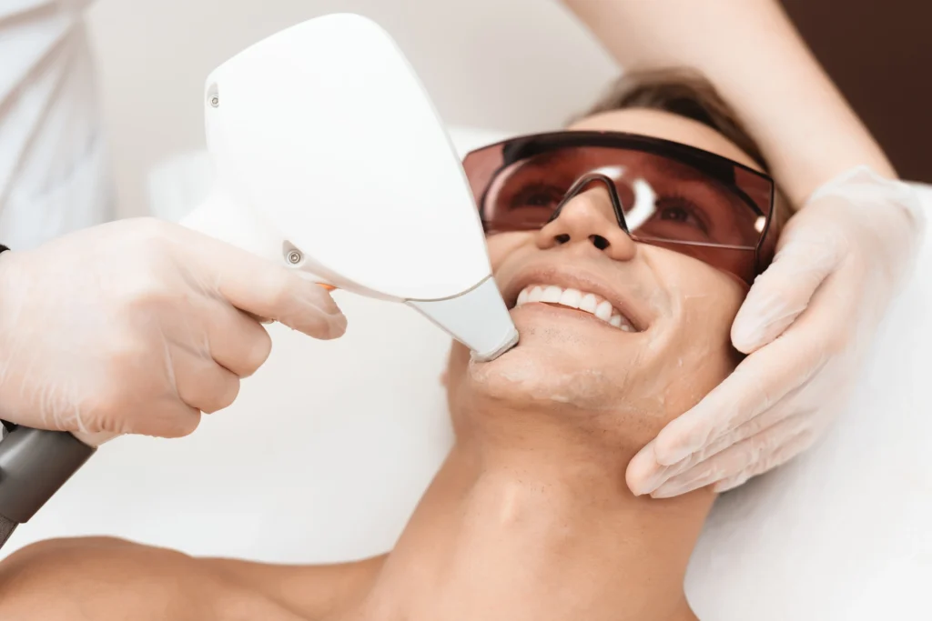 Advanced IPL – Beard